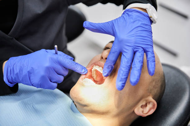 Best Broken or Cracked Tooth Emergency Dentist in Hurlock, MD